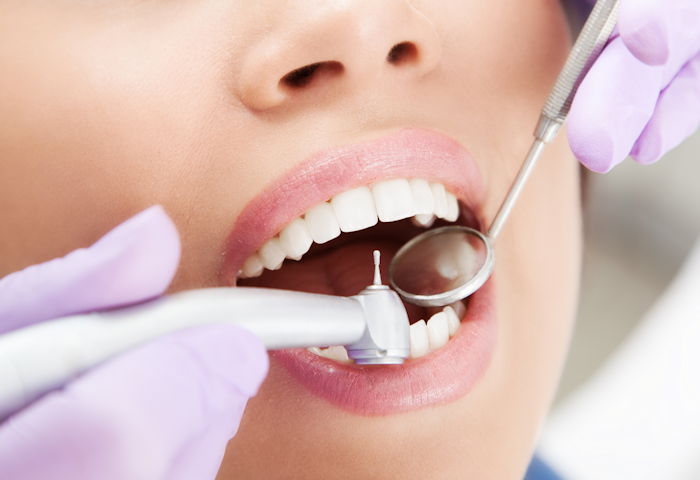 Scaling And Root Planing: Deep Cleaning For Gum Health