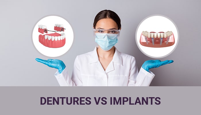 Dental Implants